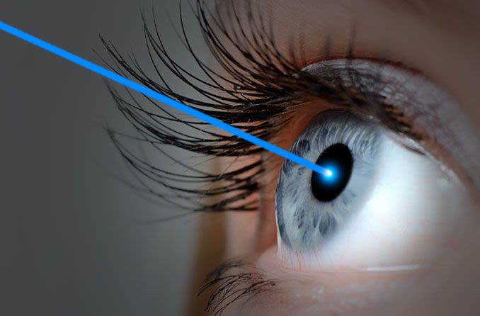 Person receiving Lasik eye procedure.